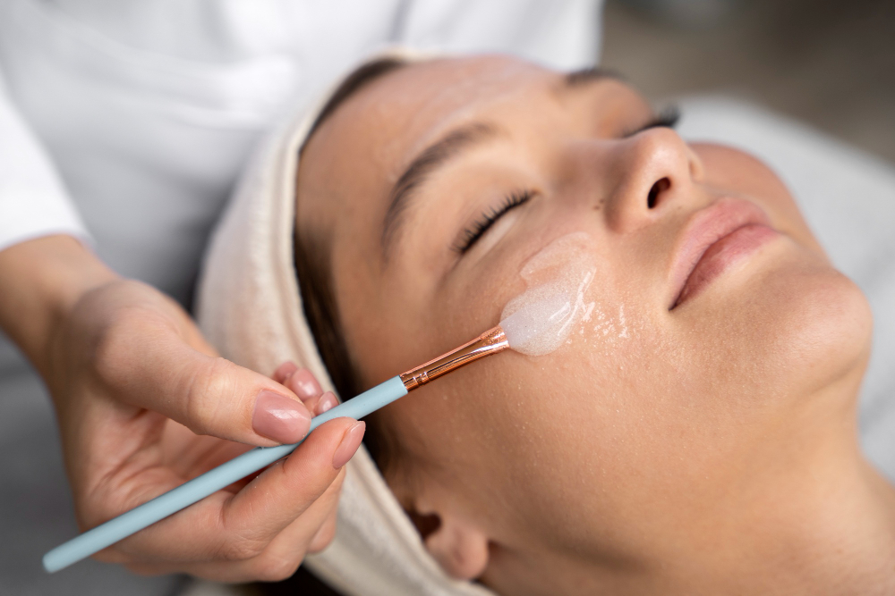 Chemical Peels